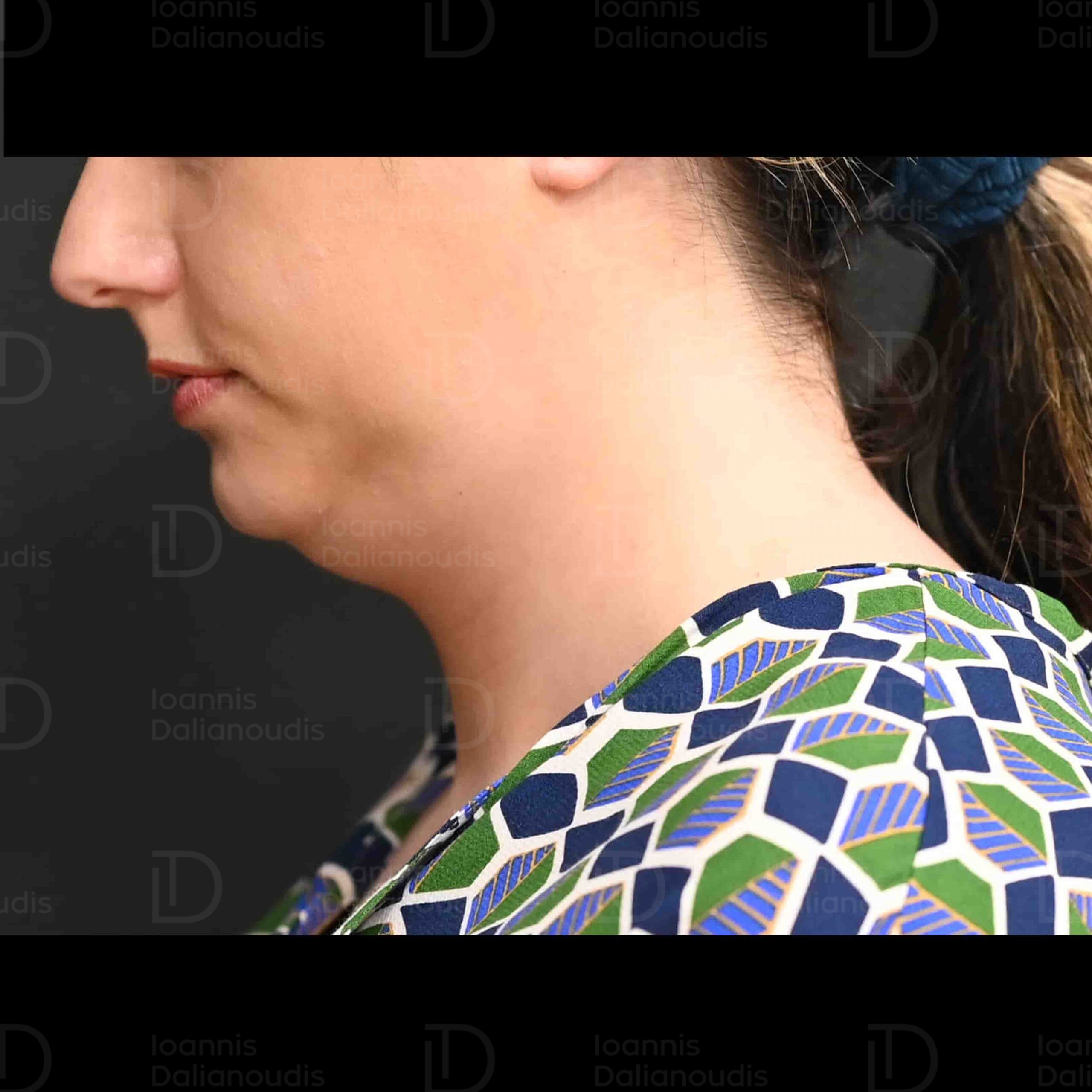 Dalinoudis logo